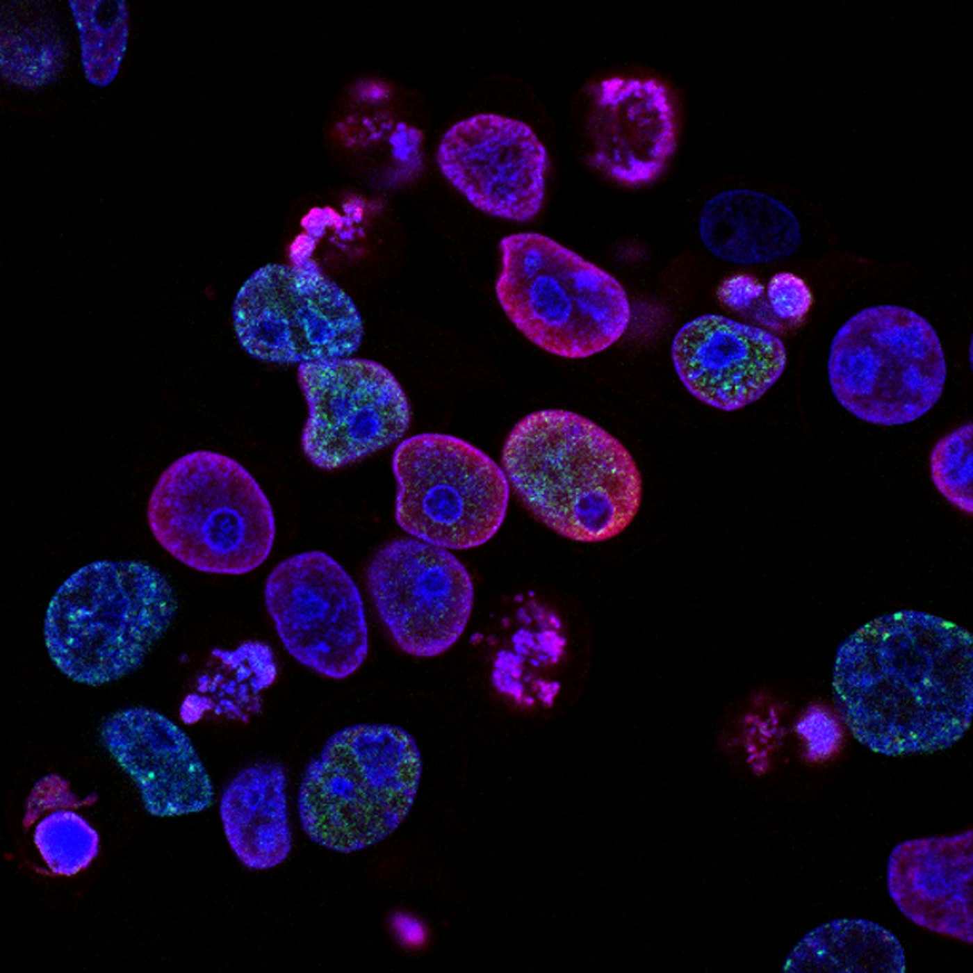 Fluoreszenzmikroskopie von Zellkernen
